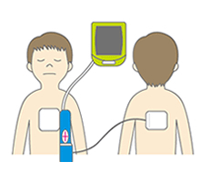 やむを得ず、未就学児に使う場合